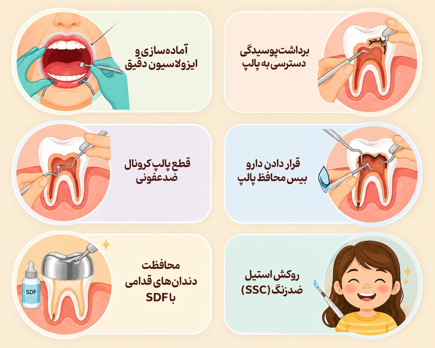 مراحل عصب کشی