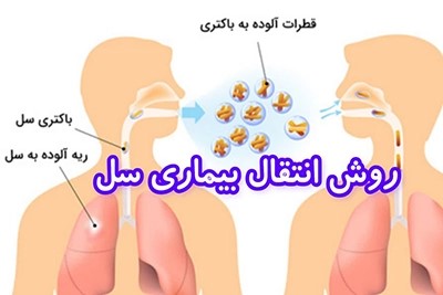 راه انتقال سل